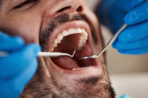 Best 24-Hour Emergency Dentist in New Orleans Station, LA
